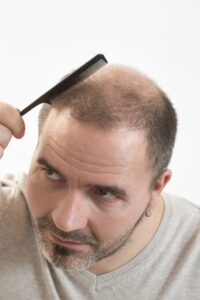 Signs for Hair Transplant Surgery by Virginia Surgical Center